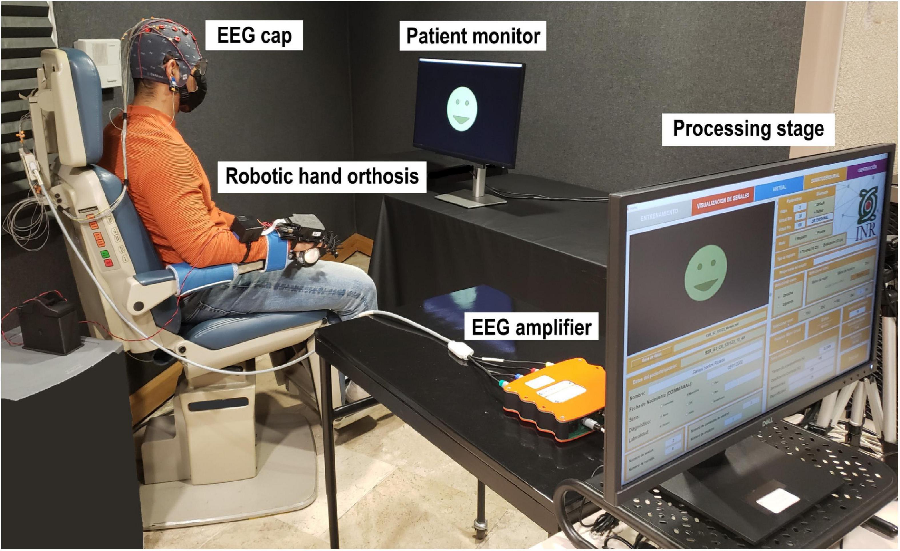 Continuous versus discrete robotic feedback for brain-computer interfaces aimed for neurorehabilitation